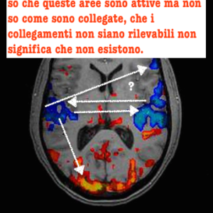 fmri-brain_t